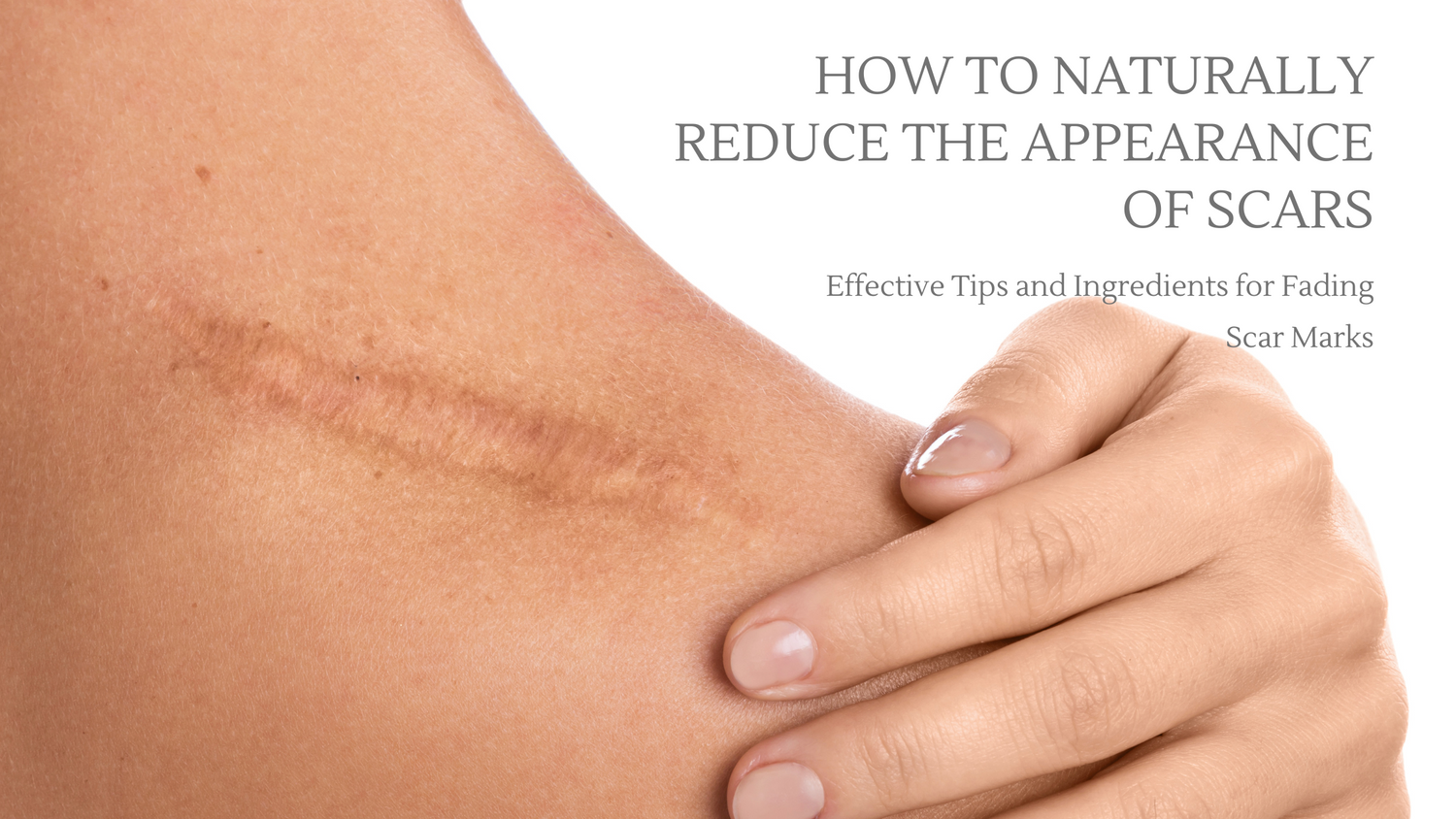How to naturally reduce the appearance of scars