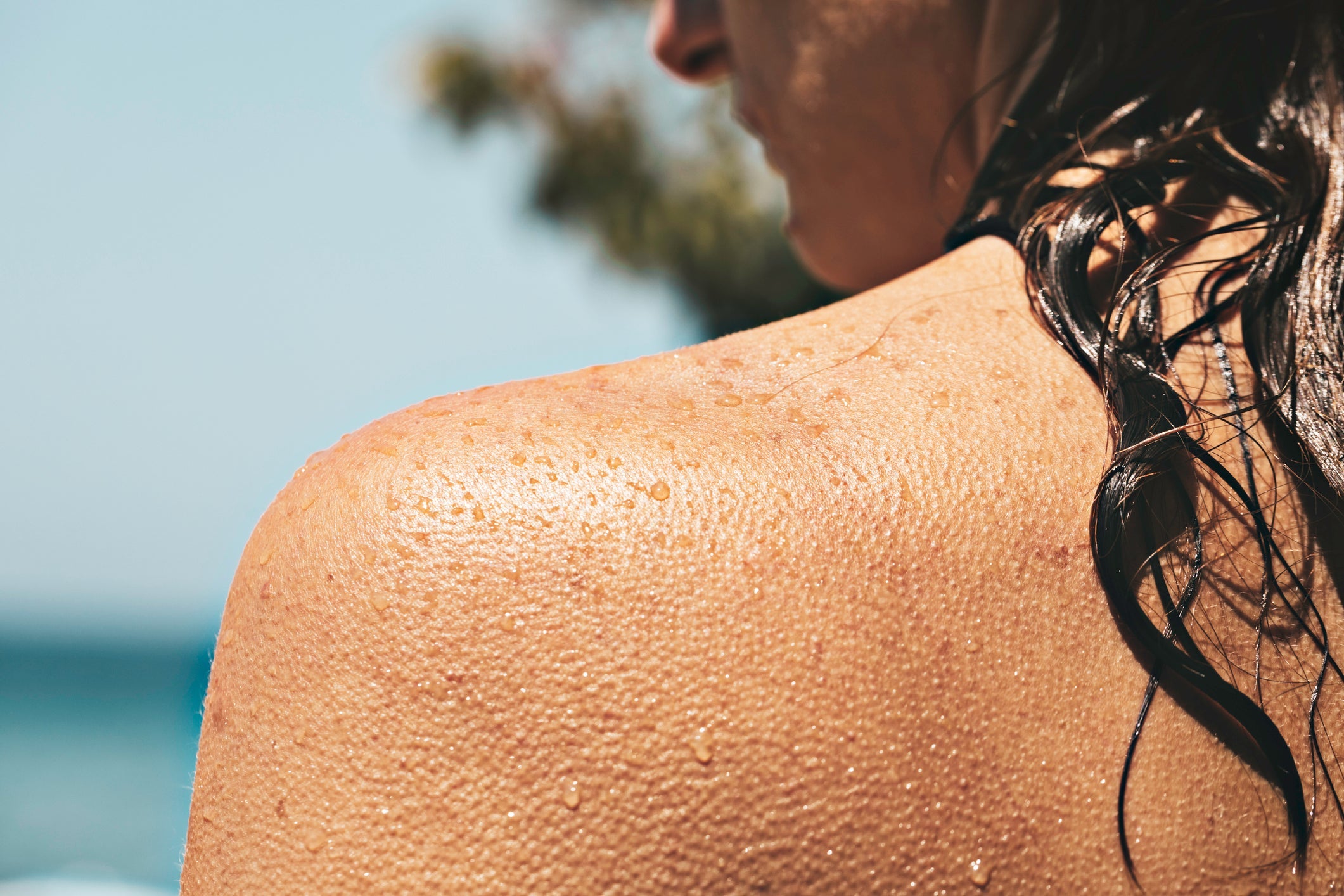 8 Natural skincare tips for summer