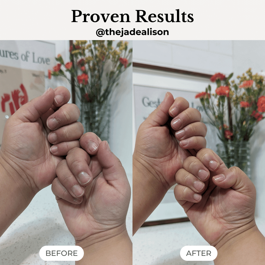 Intensive Repair for Cracked and Calloused Hands